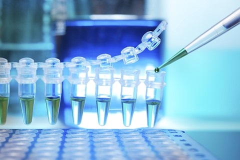 laboratorni-vzorky_shutterstock_159286807__480x320pxl.jpg